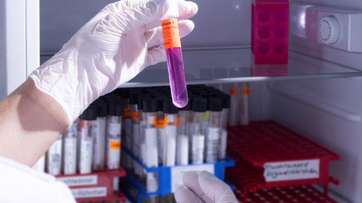 Bild von Spezialist:in für Labormedizin FAMH, Medizinische Genetik